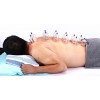 AcuTop Cupping Set 19-delig AcuTop Cupping Set 19-delig