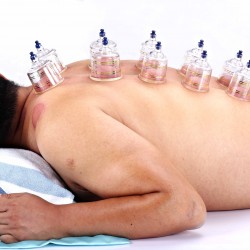 AcuTop Cupping Set 19-delig