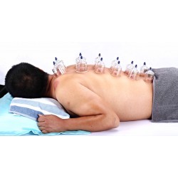 AcuTop Cupping Set 19-delig AcuTop Cupping Set 19-delig