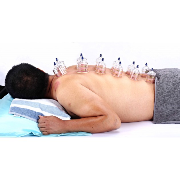 AcuTop Cupping Set 19-delig AcuTop Cupping Set 19-delig