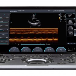 Chison SonoAir Echo Apparaat Chison SonoAir Echo Apparaat