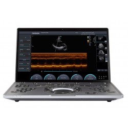 Chison SonoAir Echo Apparaat Chison SonoAir Echo Apparaat