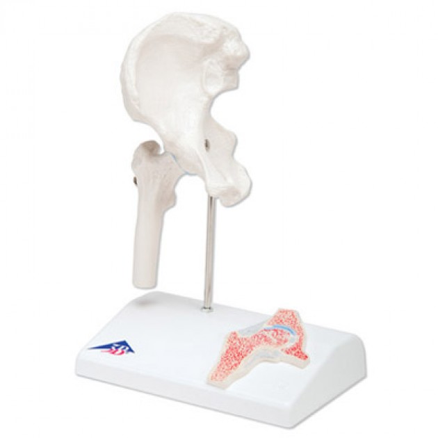Anatomisch Model Mini Heup Anatomisch Model Mini Heup