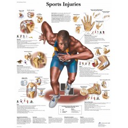 Poster Sportblessures (Dubbelzijdig Gelamineerd) Poster Sportblessures (Dubbelzijdig Gelamineerd)