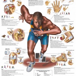 Poster Sportblessures (Dubbelzijdig Gelamineerd)