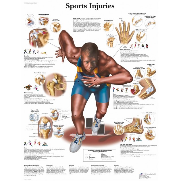 Poster Sportblessures (Dubbelzijdig Gelamineerd) Poster Sportblessures (Dubbelzijdig Gelamineerd)