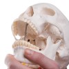 Schedel op cervicale wervelkolom Schedel op cervicale wervelkolom