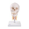Schedel op cervicale wervelkolom Schedel op cervicale wervelkolom